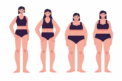 Collage de dos cuerpos con mismo IMC pero diferente composición.